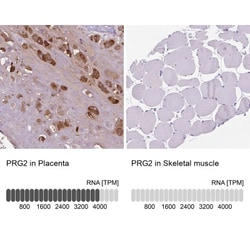 PRG2 Antibody, Novus Biologicals 0.1mL; Unlabeled:Antibodies, Polyclonal